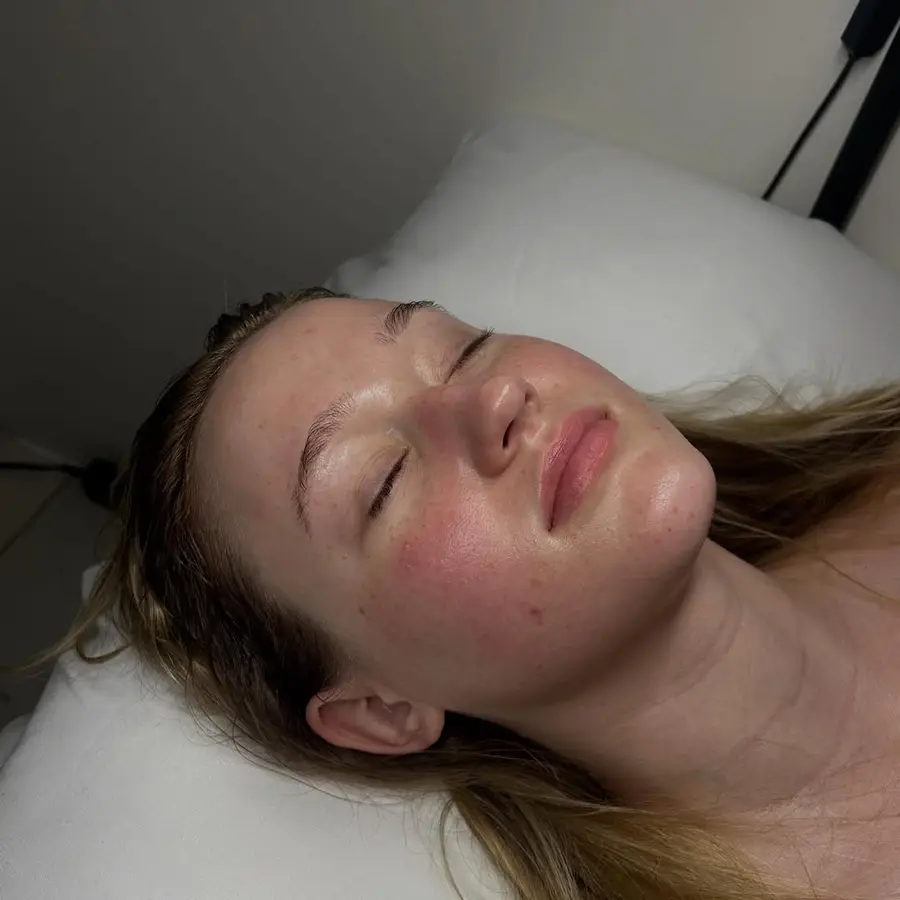 Close-up of a client's dewy, glowing skin after a results-driven facial at OH! Esthetics